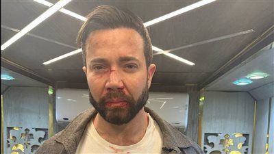 تامر شلتوت والمشهد الذي تحول إلى حقيقة! 