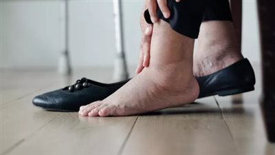 تورم الكاحل: الأسباب والعلاج وكيفية التعامل معه