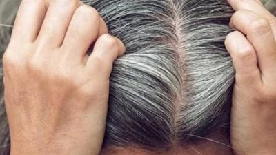 الشيب المبكر.. الأسباب وطرق الوقاية والعلاج