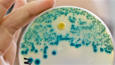 علماء يحددون بكتيريا لمكافحة الآفات الحشرية