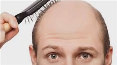  علاج طبيعي لتساقط الشعر (تفاصيل)