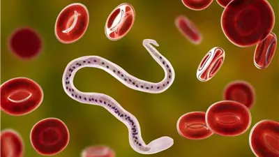 انتبه.. علامات تنذرك بإصابتك بالديدان الطفيلية