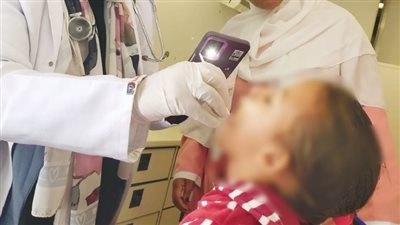 قافلة الحي الـ 30 بالعاشر من رمضان تقدم الخدمة لأكثر من 2200 مريض