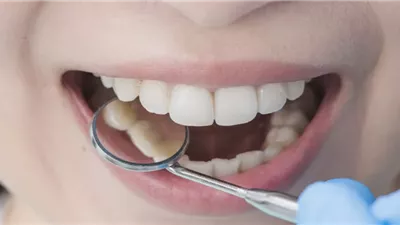 أطباء ينصحون بهذه الأطعمة لتعزيز صحة الأسنان