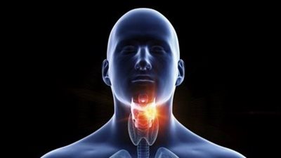 (التهاب الحلق المتكرر..عرض سرطانى)