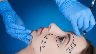 هل انتهى عصر الفيلر؟  شد الوجه الهادئ يكتسح عالم الجمال