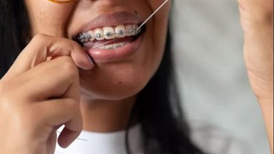 طرق لتحسين صحة اللثة..دليلك للوقاية والعناية
