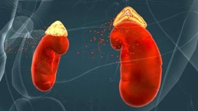 طبيبة تحذر.. شكل شائع للجلد هو أحد أعراض ورم الغدة الكظرية