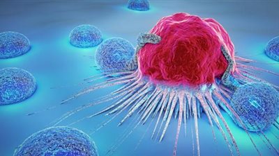 طبيب يوضح أسباب الأورام القاتلة وطرق الوقاية منها