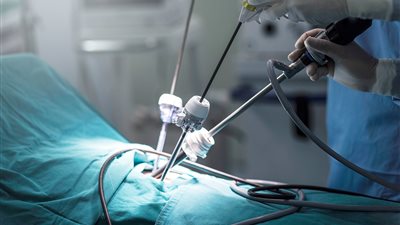 استئصال ورم في العمود الفقري لأول مرة بإستخدام المنظار