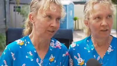 توأم متطابق يفكر بنفس الطريقة يثير الجدل حول العالم 