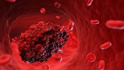 خبراء يطورون تقنية يابانية لرصد تخثر الدم دون تدخل جراحي