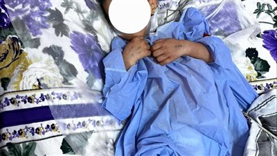 إنقاذ حياة طفل بمستشفيات جامعة سوهاج عقب تعرضه لحادث مروع 