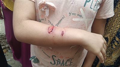 «عقرهم حيوان يشبه السلعوة».. إصابة 7 أطفال فى حى الصوفى بالفيوم