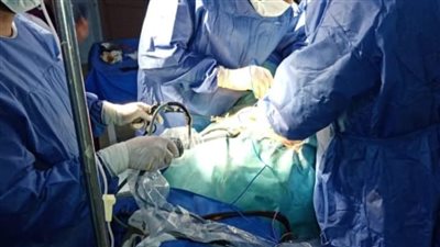 إستئصال رحم بالمنظار الجراحي بمستشفي إدكو المركزي