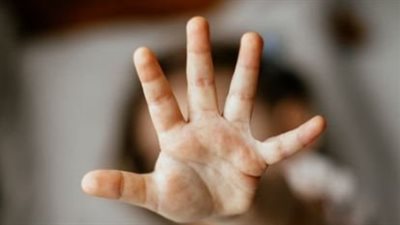 علامة بجسم الطفل تؤكد تعرضه للتحرش.. طبيب مصري يكشف