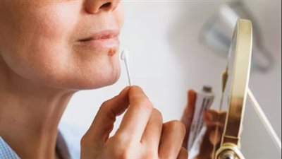 دراسة صادمة: فيروس الهربس يزيد خطر الإصابة بالزهايمر 