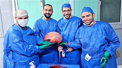 استئصال ورم يزن 15 كيلو من بطن فتاة بالفيوم 