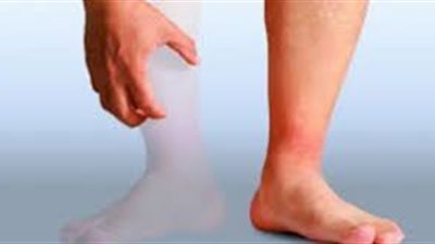 اكتشاف آلية جينية تساعد على استعادة الأطراف المفقودة (تفاصيل)