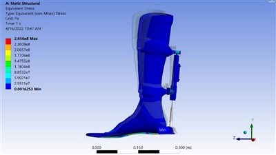 علماء روس يبتكرون جهازًا ينقذ الساقين من البتر