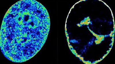 دراسة جديدة: فيروس يعيد تشكيل الحمض النووي البشري خلال ساعة واحدة 