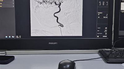 اعتماد وحدة جديدة لجراحة الوجه والفكين بمستشفى ميت غمر