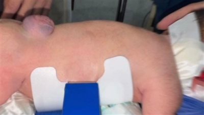 فريق طبى بمستشفي راس التين وبرج العرب ينقذ طفله رضيع من الموت بالإسكندرية 