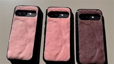 غلاف هاتف بجلد يحترق كالبشر… ابتكار غريب لتحذير المصطافين من أضرار الشمس