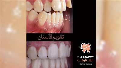   سعر التقويم في مصر 2025: دليلك لاختيار الأفضل بأقل تكلفة