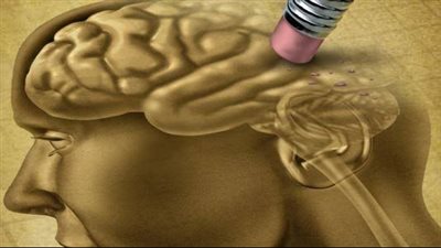  5 عادات غير صحية تضعف العقل والذاكرة.. اتركها اليوم