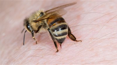 خبير يوضح طرق تجنب لسعات الدبابير المؤلمة