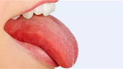 علماء ينجحون في ابتكار أول لسان اصطناعي في العالم لهذا السبب