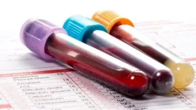 علماء روس يطورون شريحة ذكية لتحليل الدم بشكل فوري