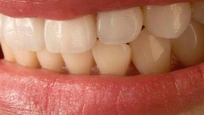 لون أسنانك يكشف عن صحتك... إليك ما يقوله العلم