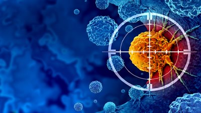 نتائج صادمة..  تمارين رياضية تكبح نمو الخلايا السرطانية