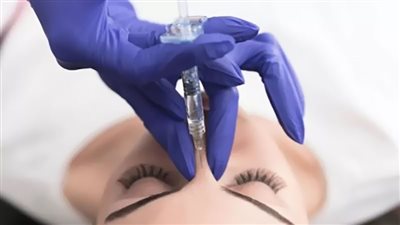 هوس التجميل.. بين المشروع والممنوع