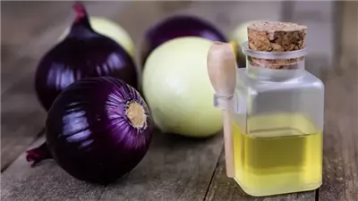 زيت البصل.. سر طبيعي لتكثيف الشعر وتحفيز نموه