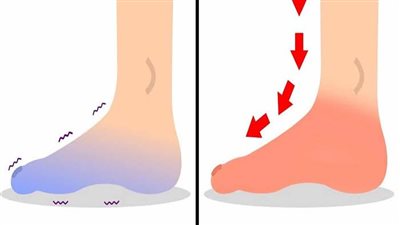   3 أعراض تكشف ضعف الدورة الدموية بالساقين.. أسرع لاستشارة الطبيب فور ملاحظتها