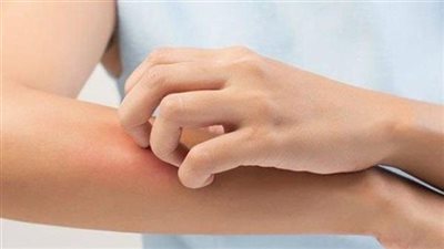 باحثون يوضحون كيف يمكن للجلد الكشف عن الصحة العقلية 