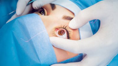 باحثون سويسريون يبتكرون قرنية شفافة لحل أزمة نقص التبرعات العالمية