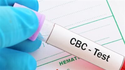 4 تحاليل لاغنى عنها لكل من تجاوز الأربعين