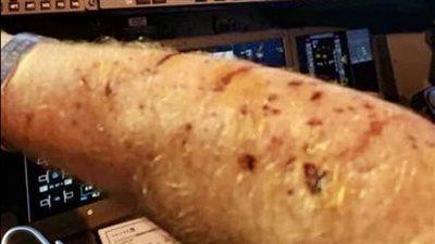 كارثة على ارتفاع 36 ألف قدم: تحطم زجاج طائرة يونايتد وإصابة القبطان