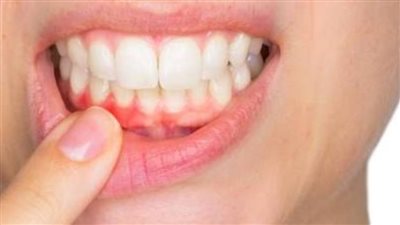 لتقوية اللثة والأسنان.. أطعمة عليك تناولها في وجبة الفطور