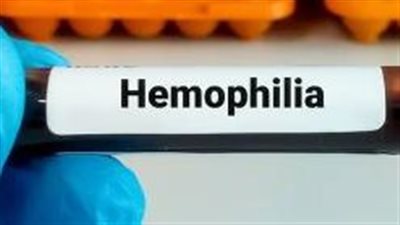 7 فحوص للدم يحتاجها كل شخص فوق سن الأربعين