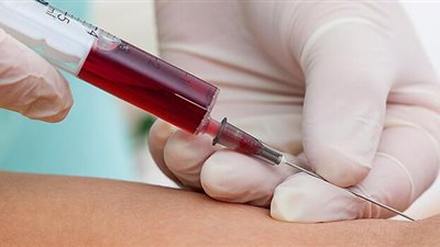 فحوصات للدم تحتاجها بعد سن الأربعين.. تعرف عليها