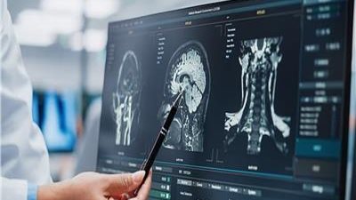 عادة خطيرة تسبب الإصابة بمرض الزهايمر