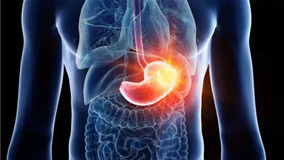 علماء يتوصلون لاكتشاف جديد يفتح آفاقا لعلاجات مبكرة لأورام الجهاز الهضمي