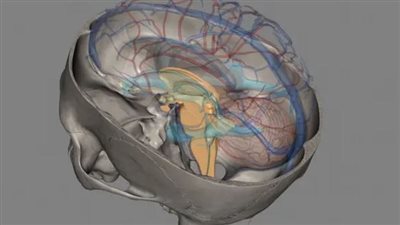 تسرب السائل النخاعي.. عندما يفقد الدماغ درعه الواقي