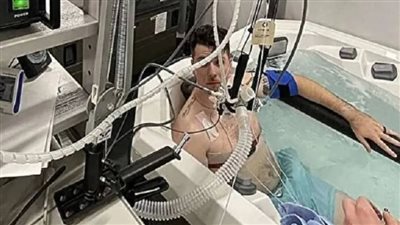 علاج حراري منزلي لخفض ضغط الدم