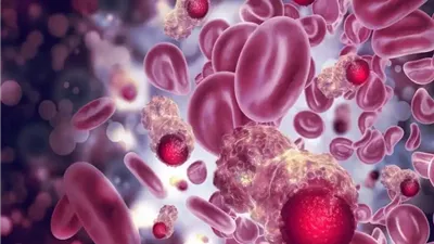 علماء روس يتوصلون لإبتكار يزيد قوة علاج سرطان الدم بمقدار ثمانية أضعاف